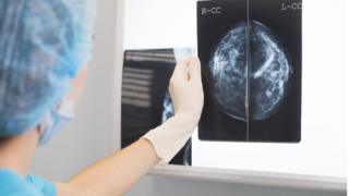Doctor in surgical clothes holds a mammogram in front of x-ray illuminator