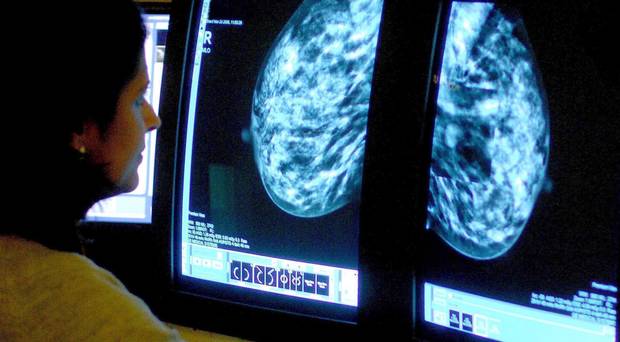 More people are having to wait longer for cancer treatment, government figures show.